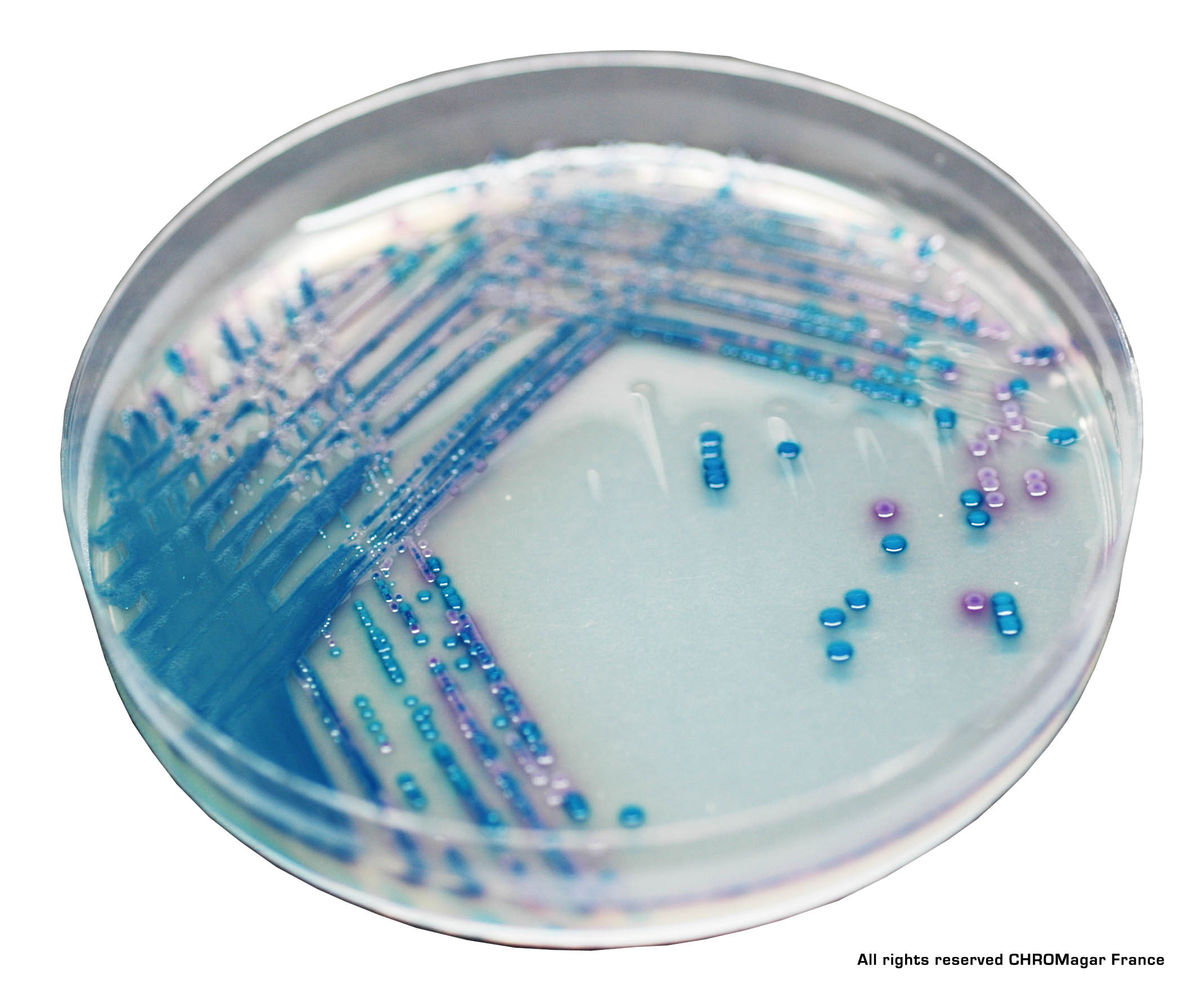 Sanimed -mTM CHROM KPC/Хромогенного середовище для виявлення грам- негативних бактерій, резистентних до карбапенем.